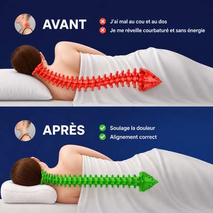 Avant / après : alignement de la colonne avec Somnea
